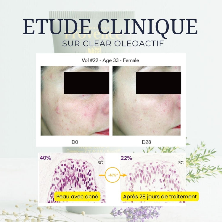 Masque purifiant et détoxifiant à l'argile verte du velay et prébiotoques pour nourrir la flore de la peau. Enrichi en clear oleoactif à base de thym et de cameline. Innovation Mademoiselle Provence, testé sur peau acnéique.